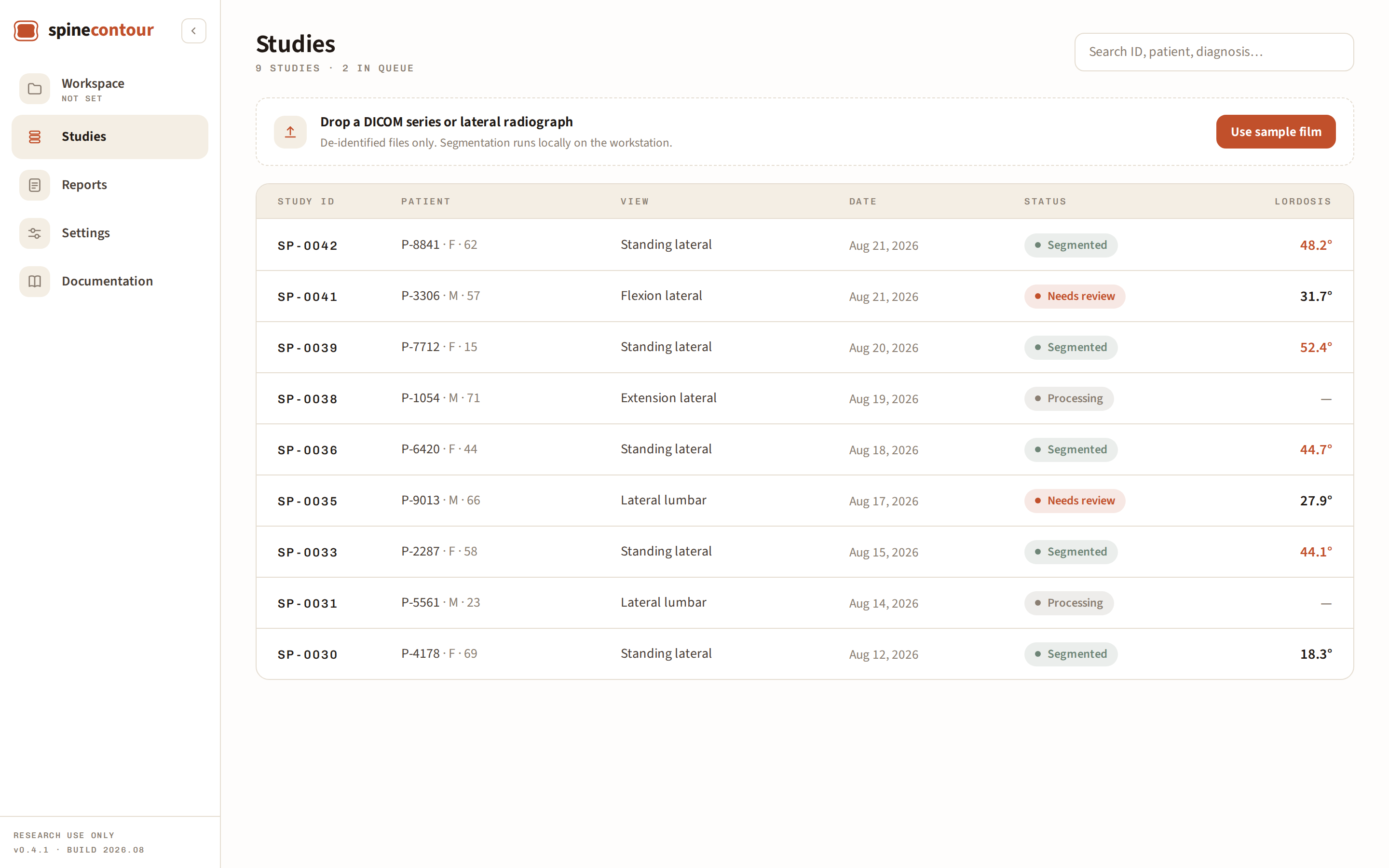 Studies screen: searchable table of studies with view, status and lordosis columns